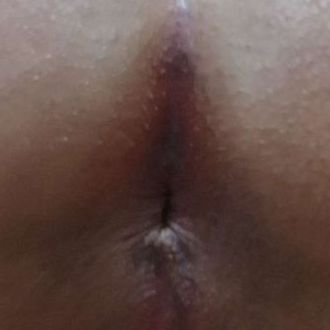 Minhas Fotos